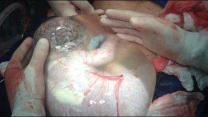 foedt-baby-med-fosterhinde