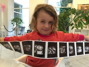 selma-lillebror-scan